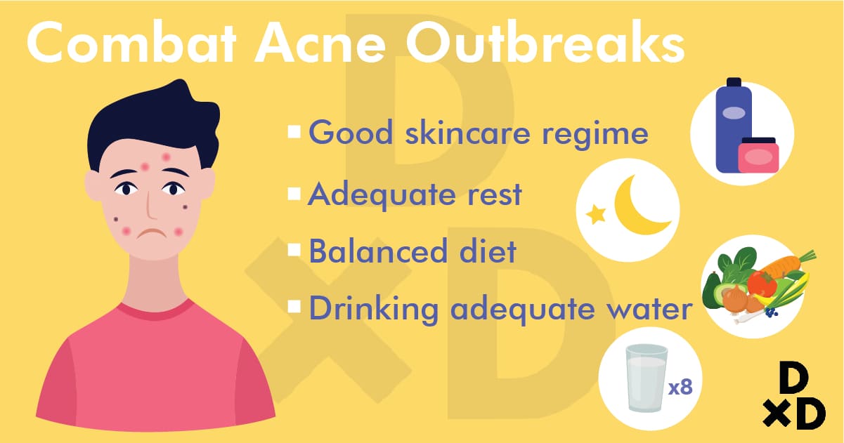 combat-acne-outbreaks