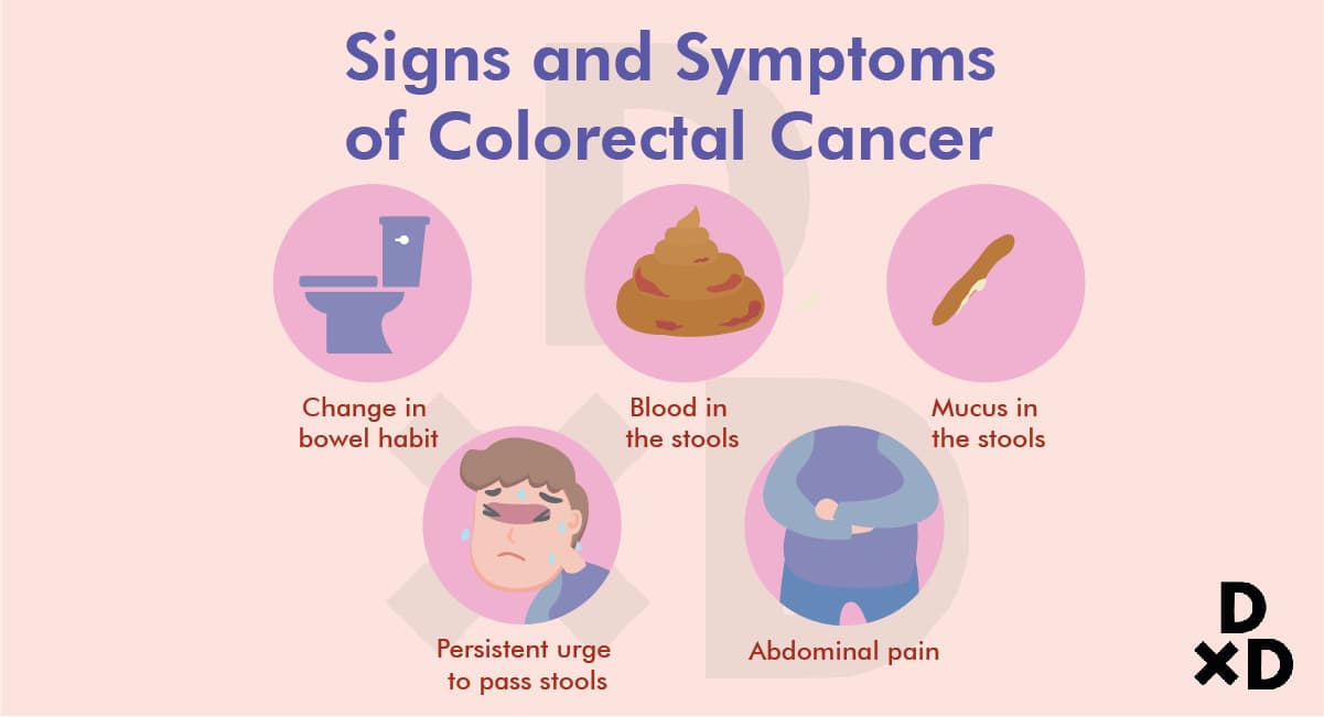 3 Common Signs of Colorectal Cancer - human