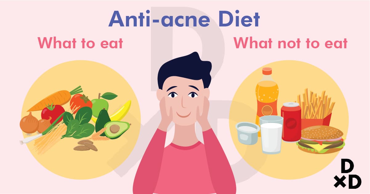 preventing-acne-with-anti-acne-diet