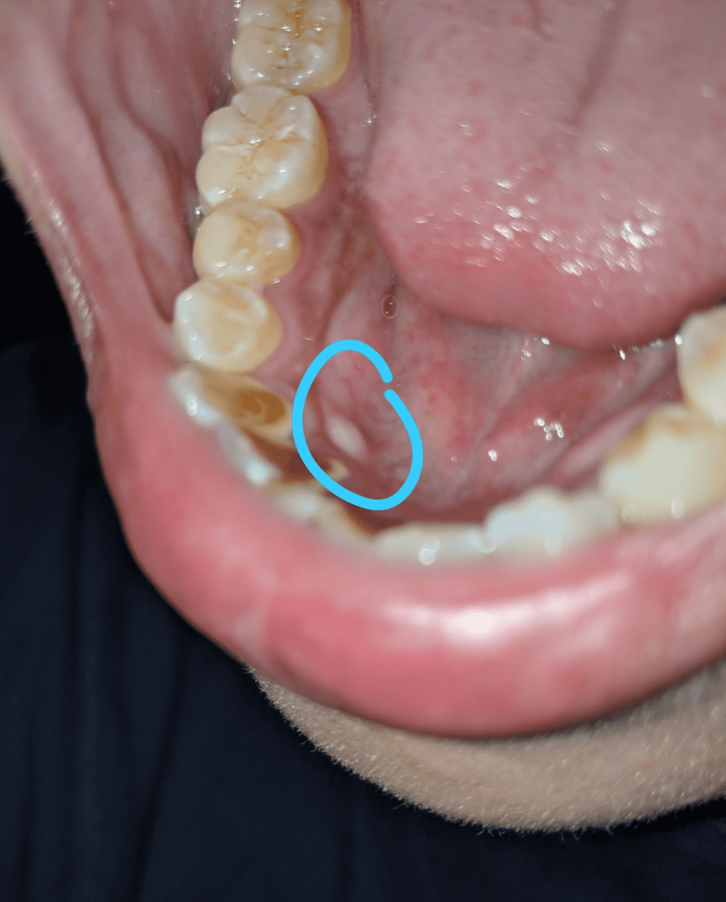 white-spots-on-your-gums-and-lips-lipstutorial