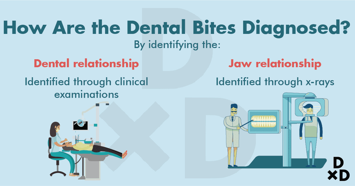 diagnose-dental-bites