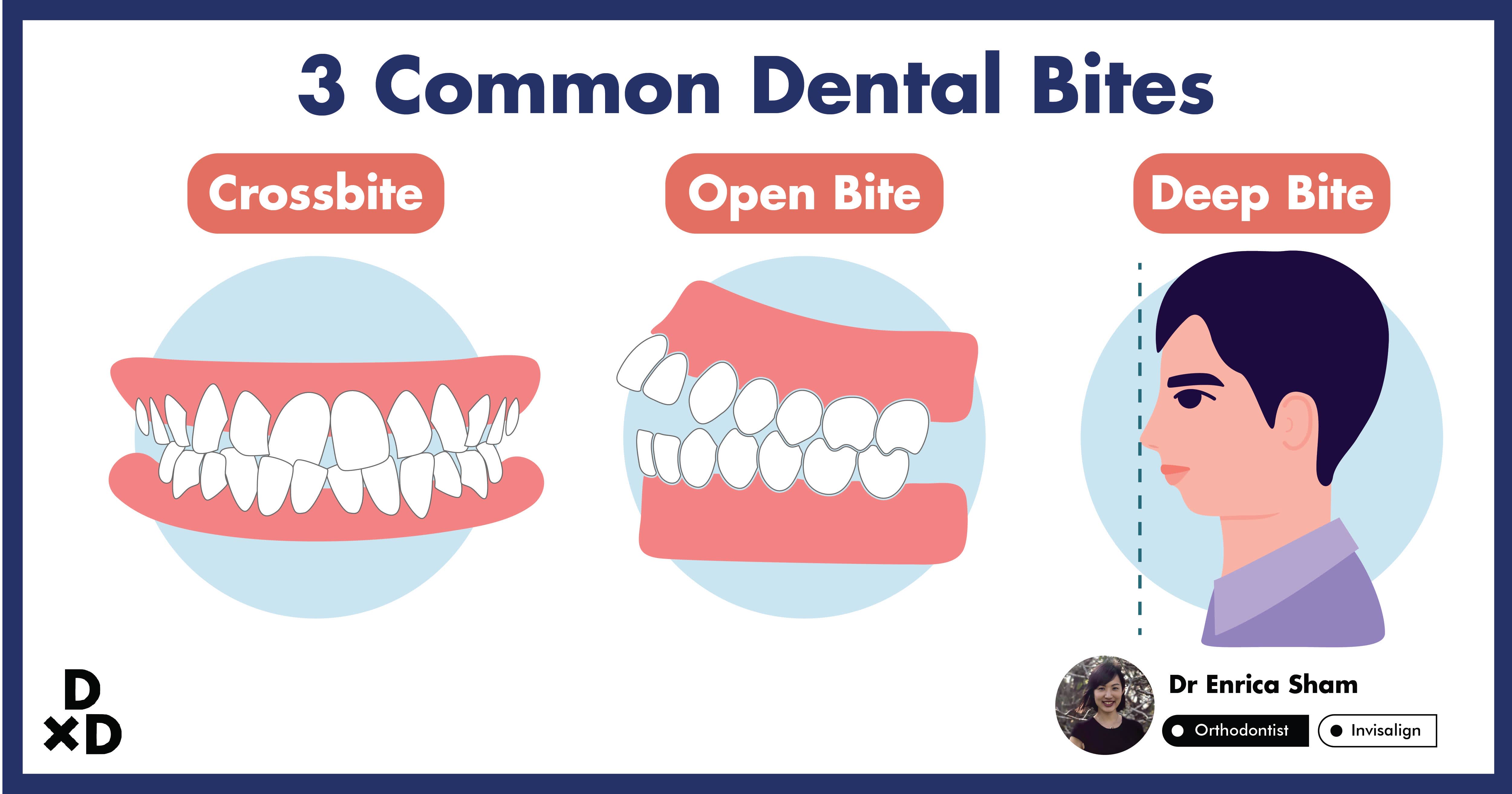 first bite dental