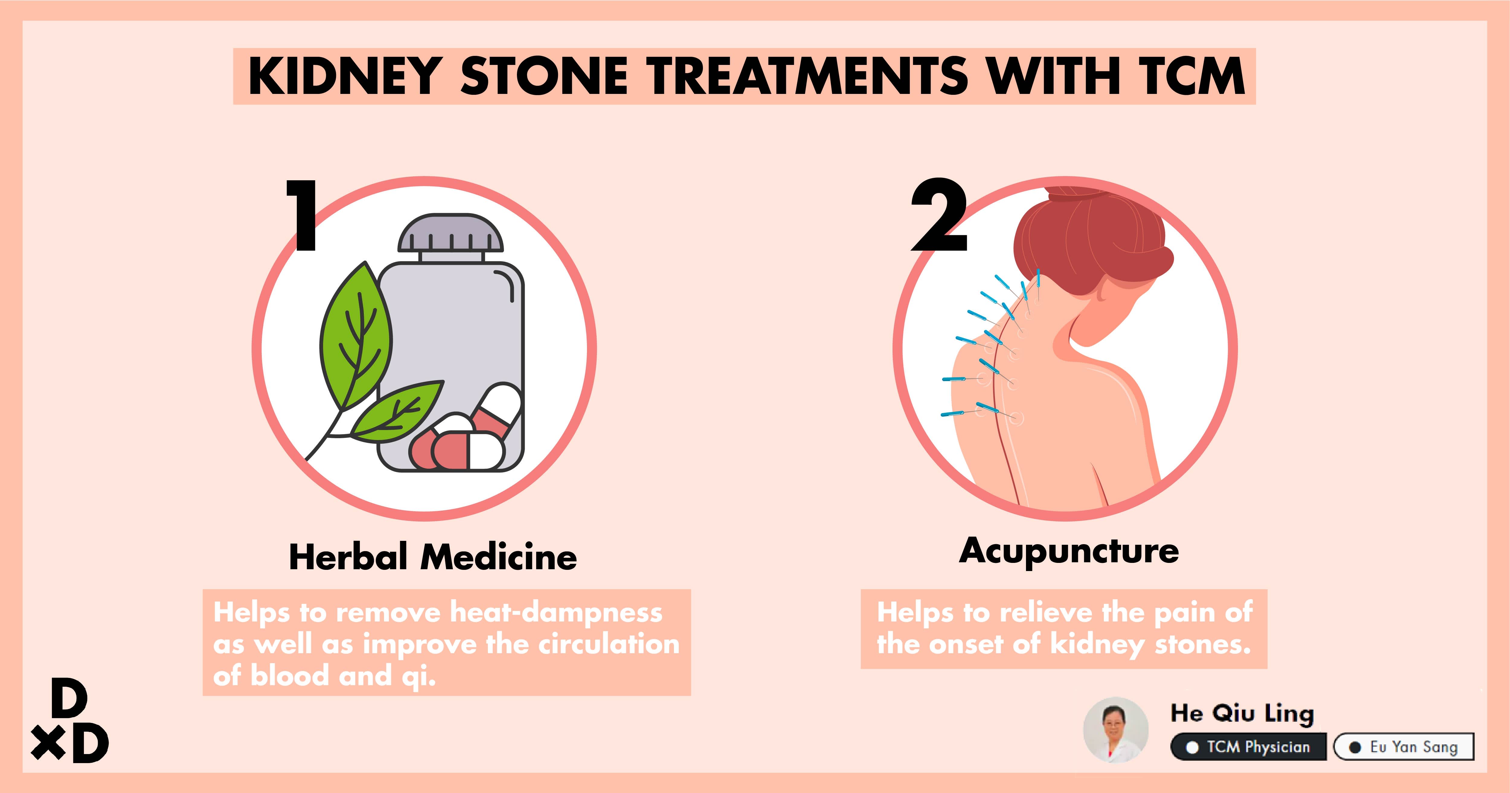 kidney stones treatment