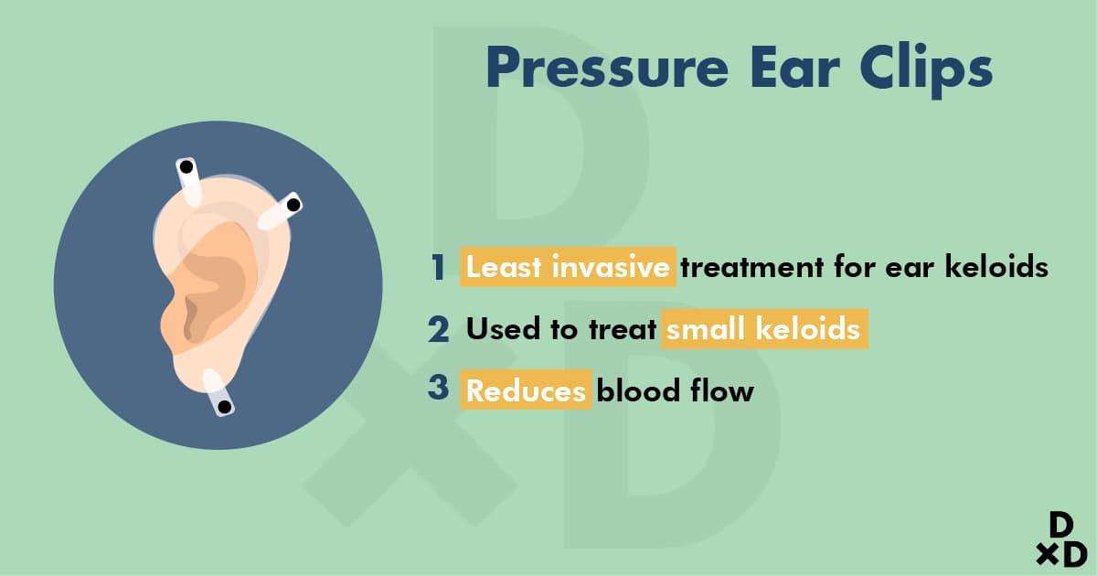 pressure-ear-clips