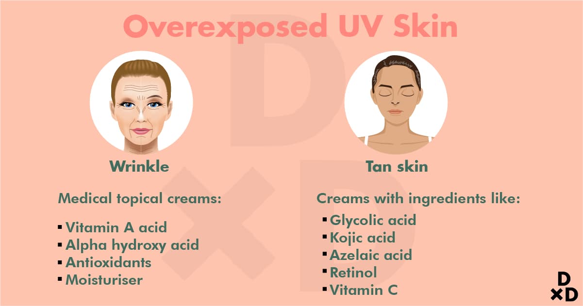 overexposed-uv-skin