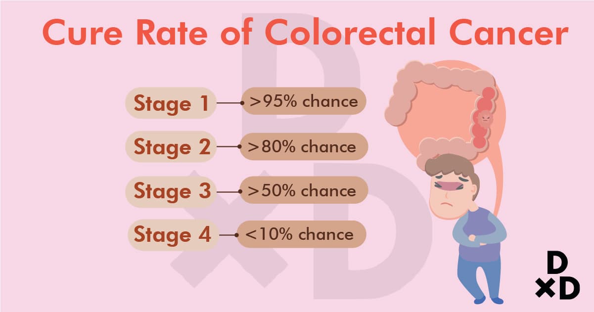 cure-rate-of-colorectal-cancer