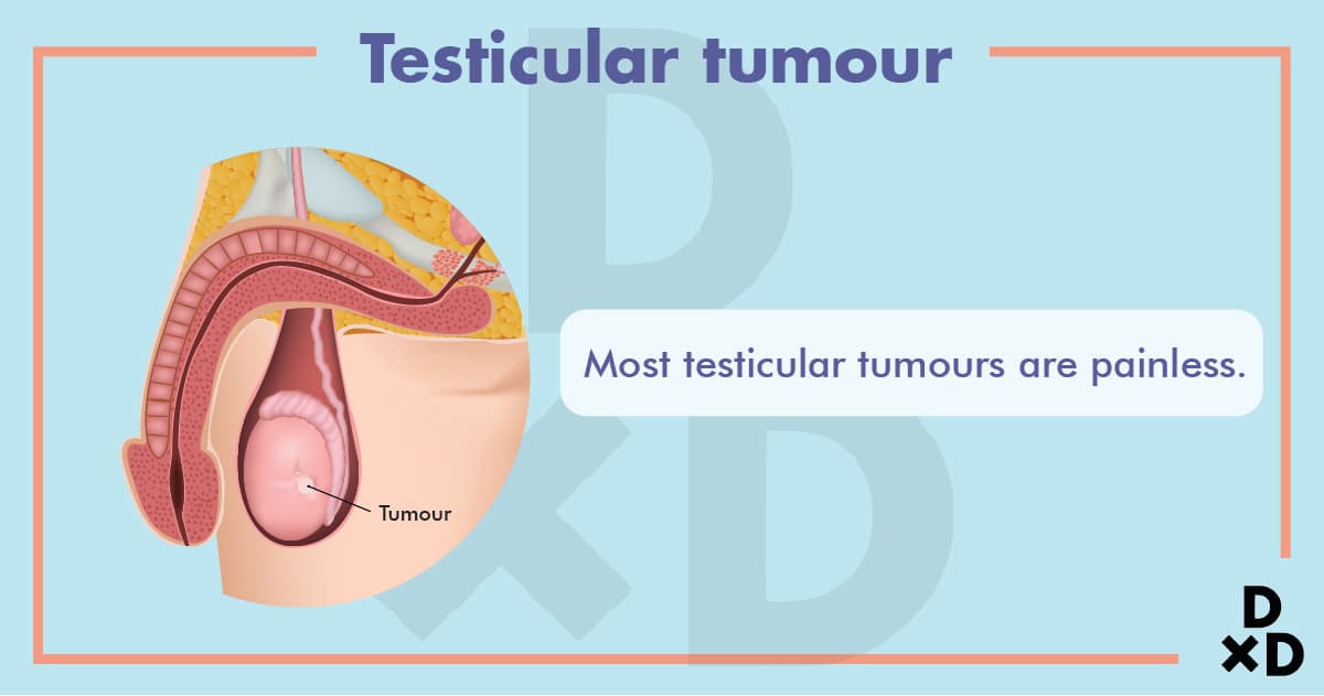 tescular-tumour