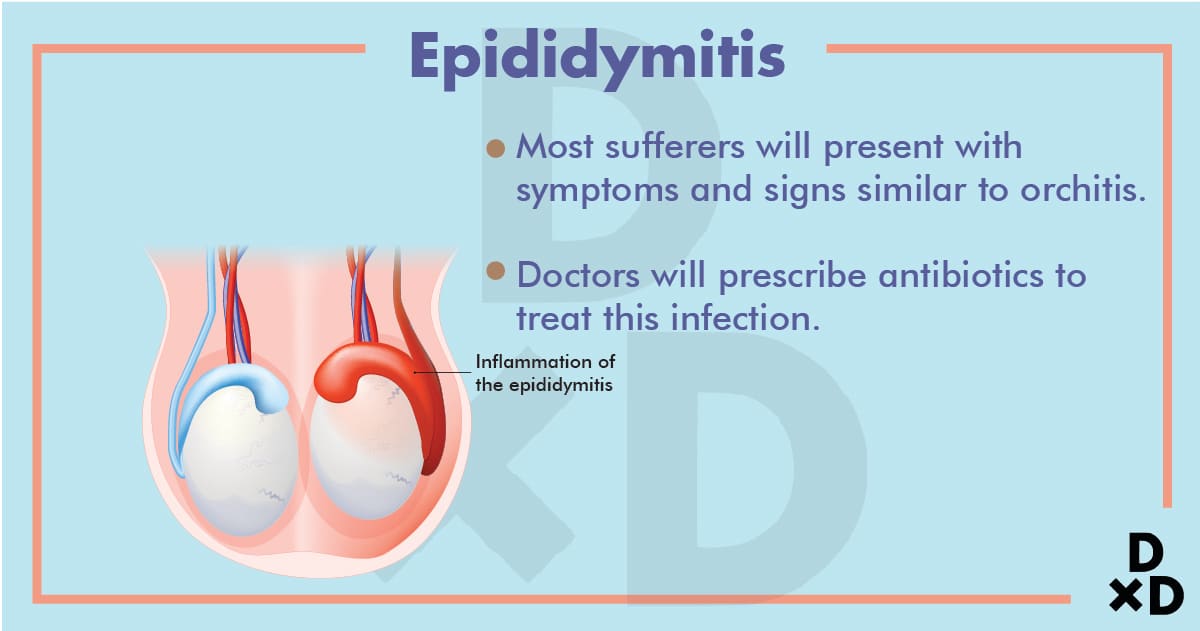 epididymitis