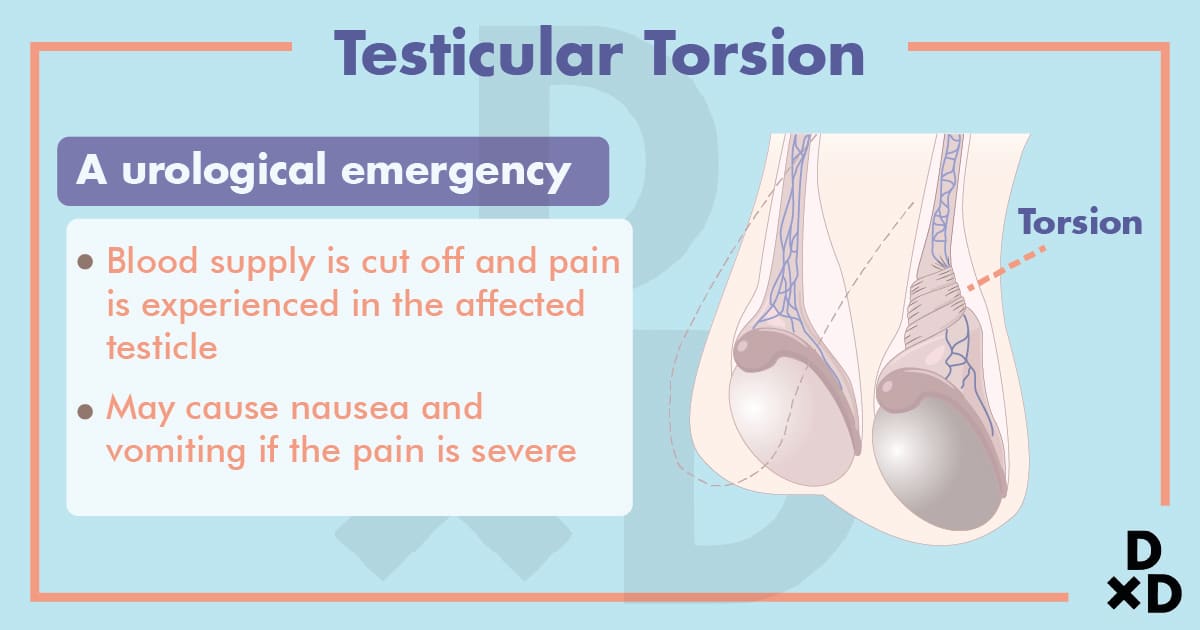 8 Causes Of Testicular Pain Explained By A Urologist 2022