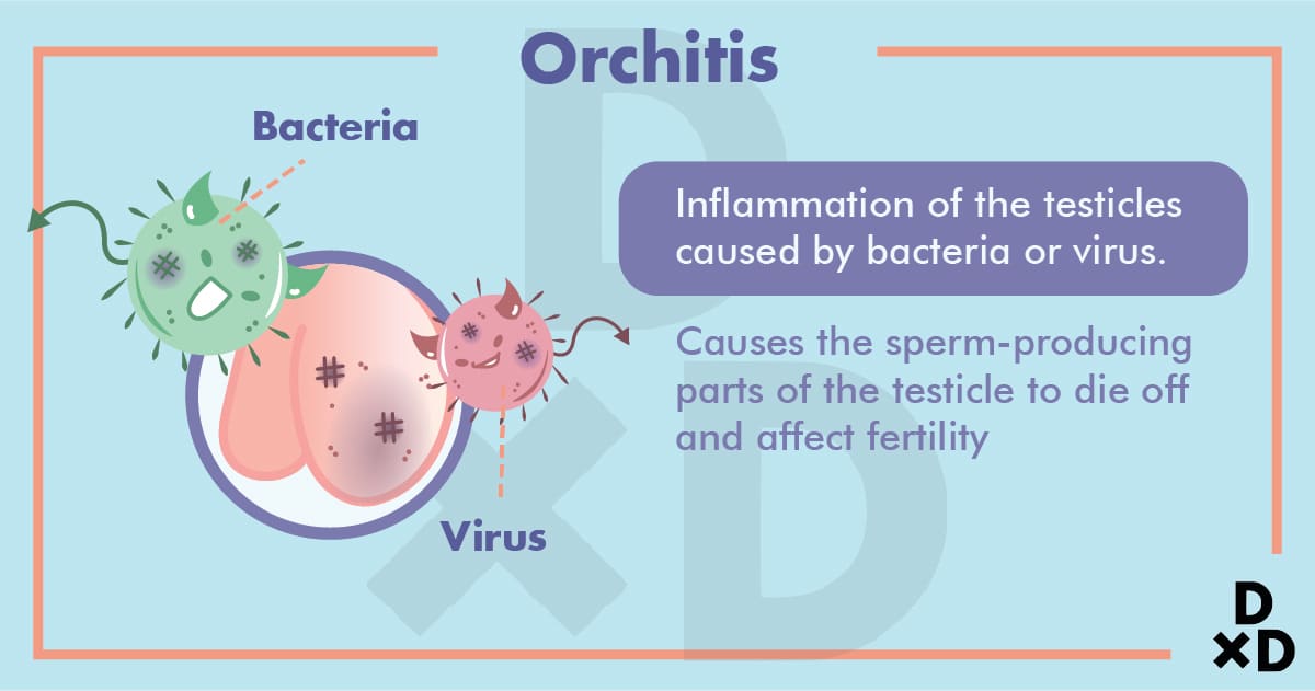 testicular-orchitis-pain-causes