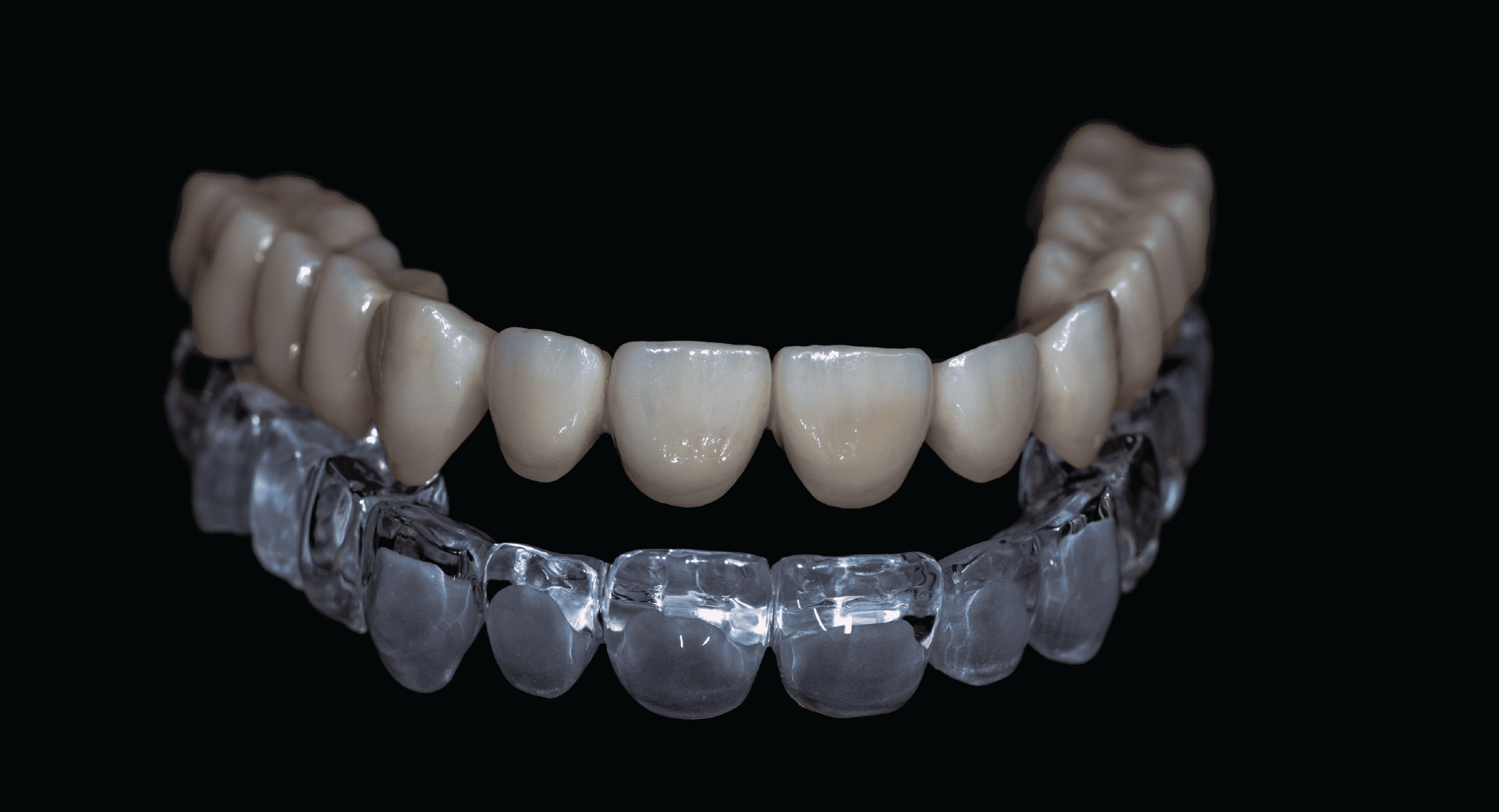 smiledesign-dental-veneers