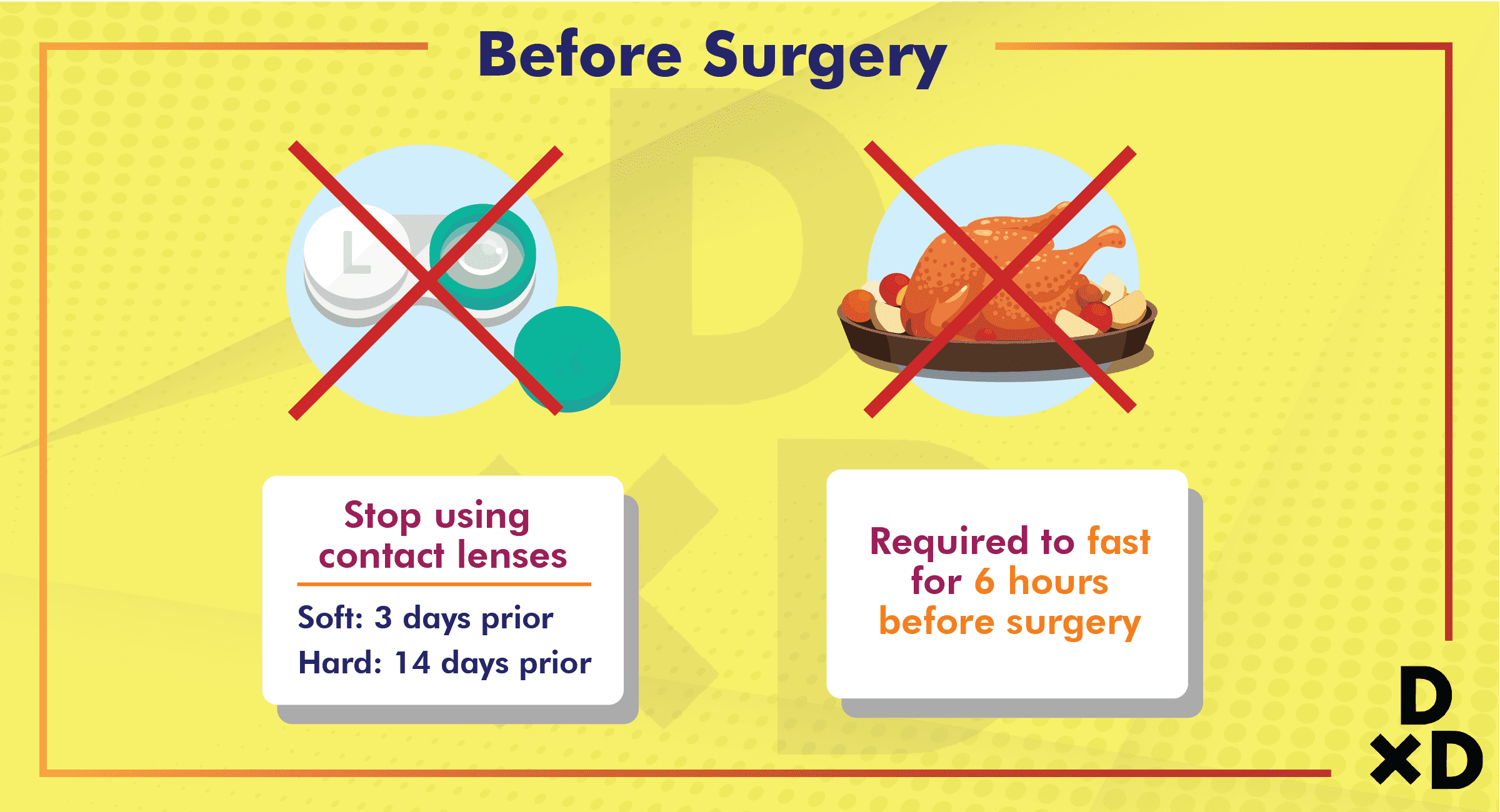 before-surgery-icl-surgery