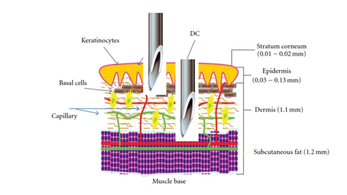 diagram-injection-manual-vs-injector-gun