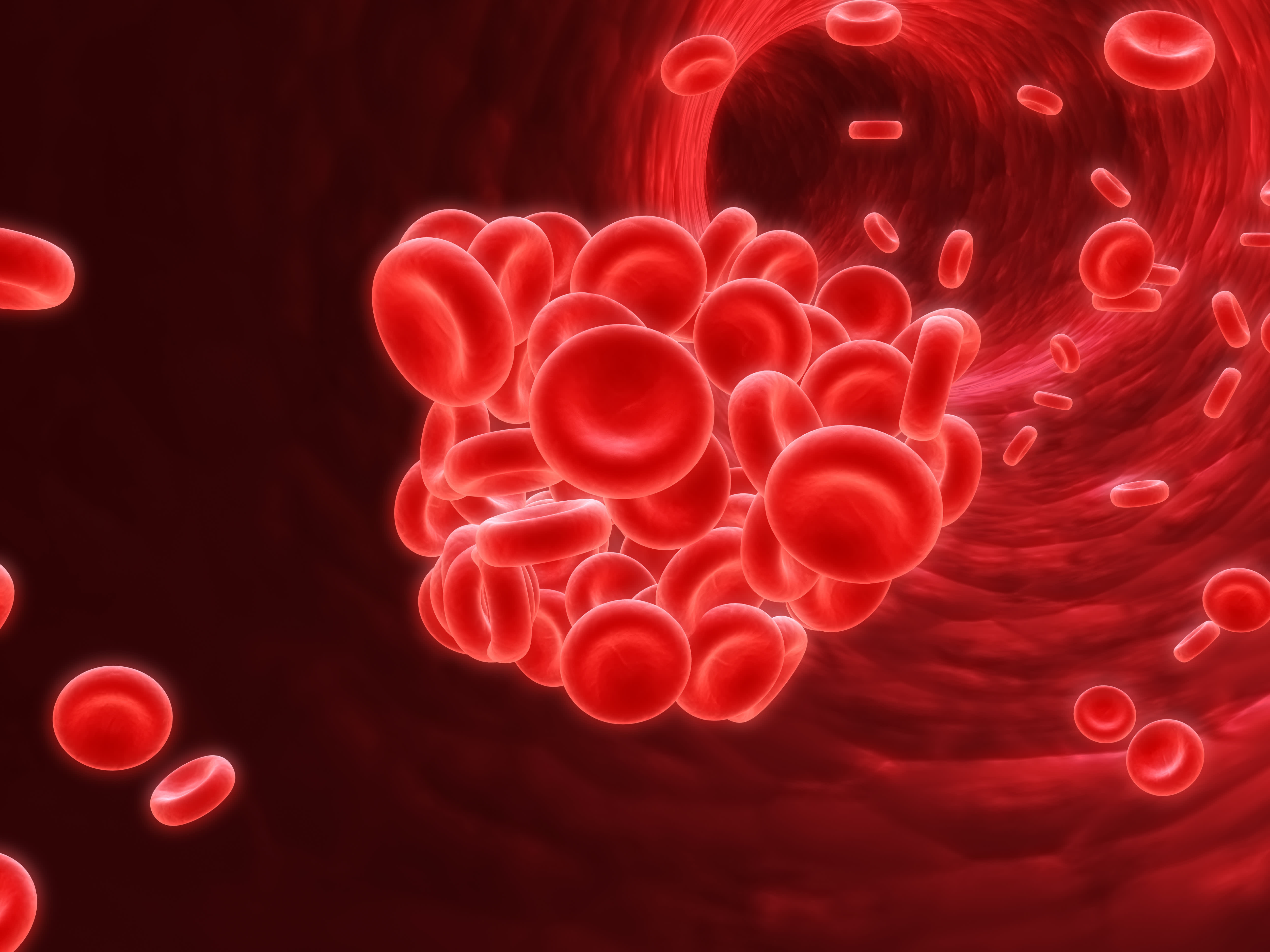 Treatment Deep Vein Thrombosis DVT