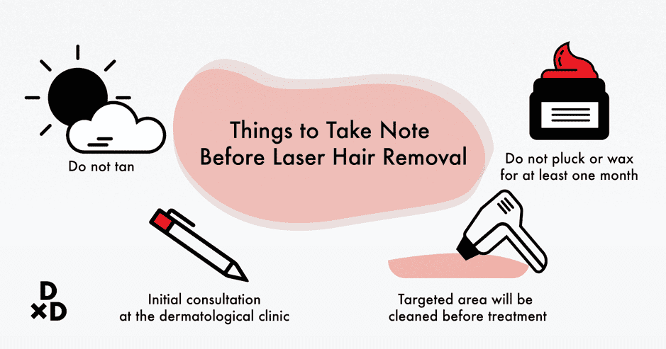 Things to take note of before laser hair removal