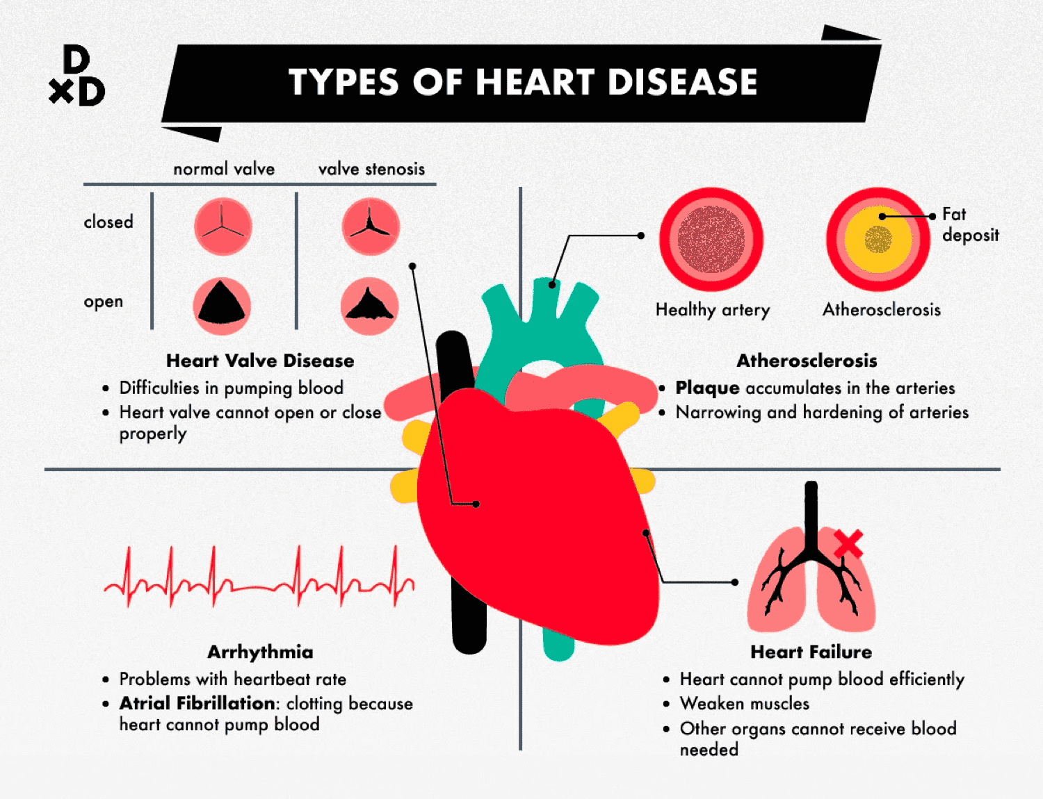 types of heart disease in women