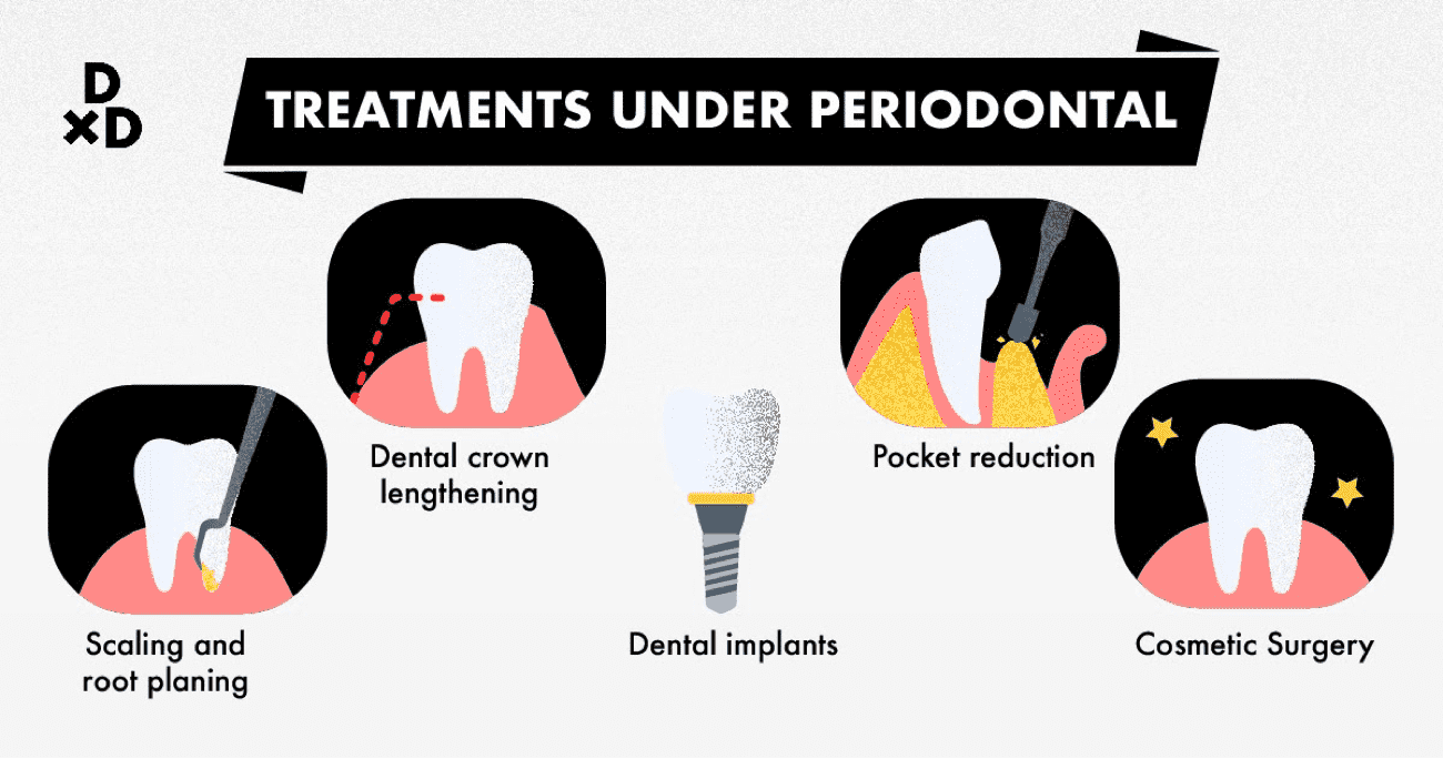 Treatments under periodontal