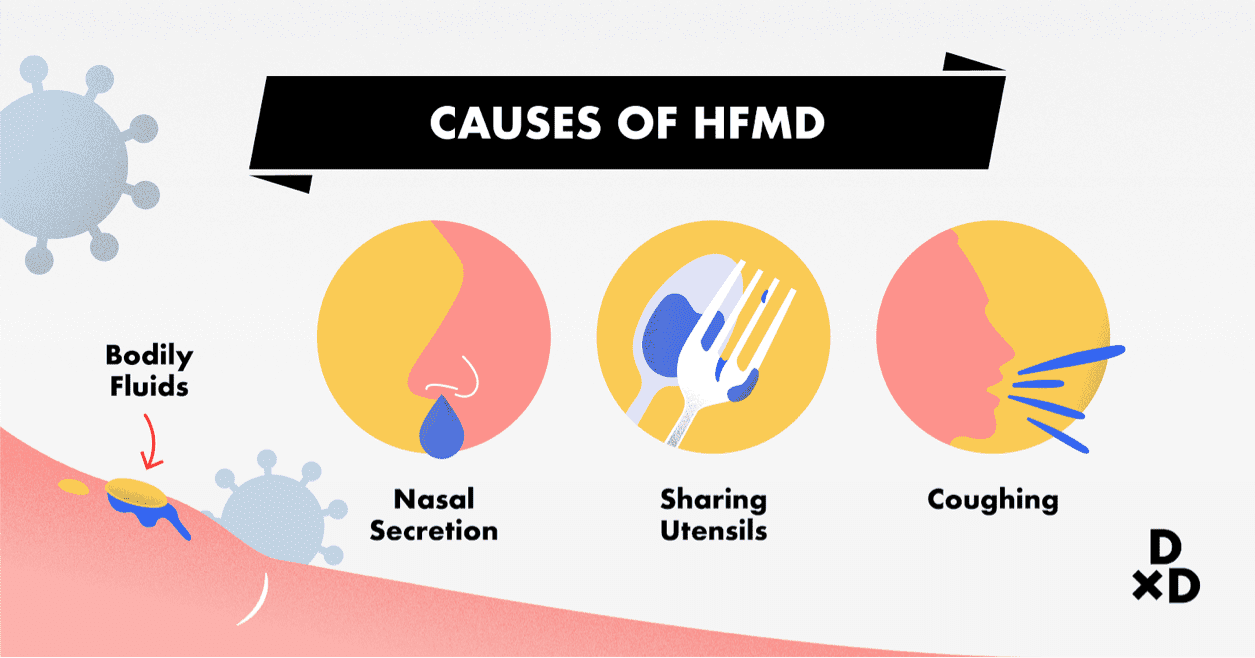 Causes of HFMD