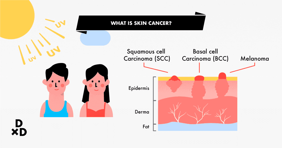 what is skin cancer