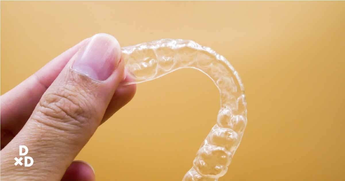 Hand holding clear aligners