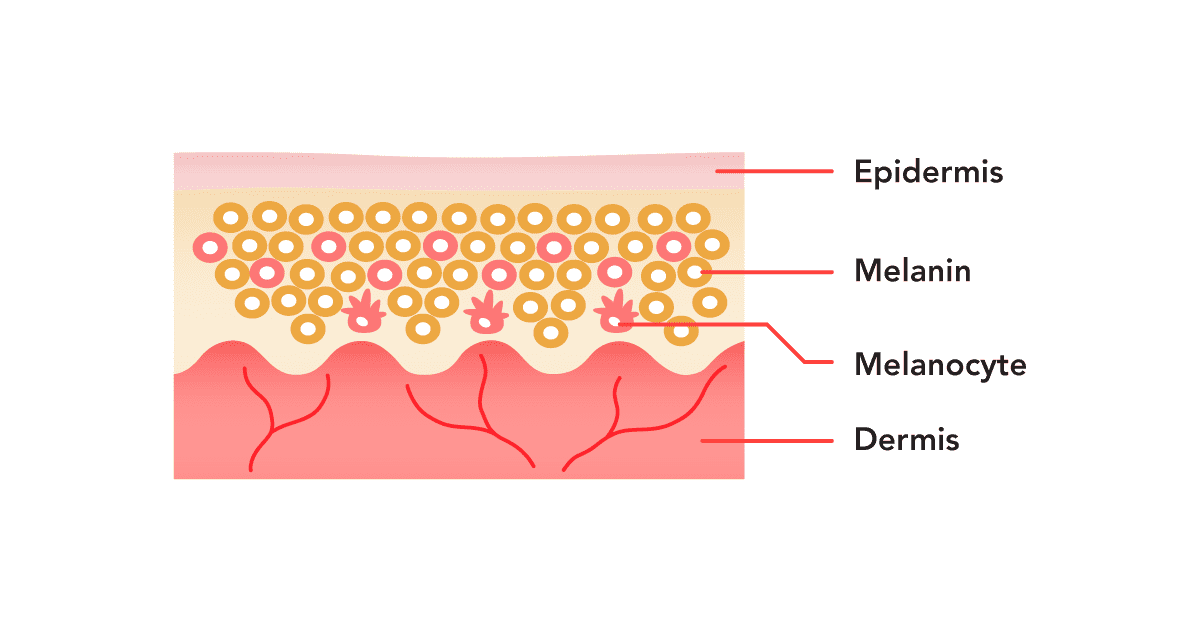 Surface to deep layers of the skin for pigmentary conditions