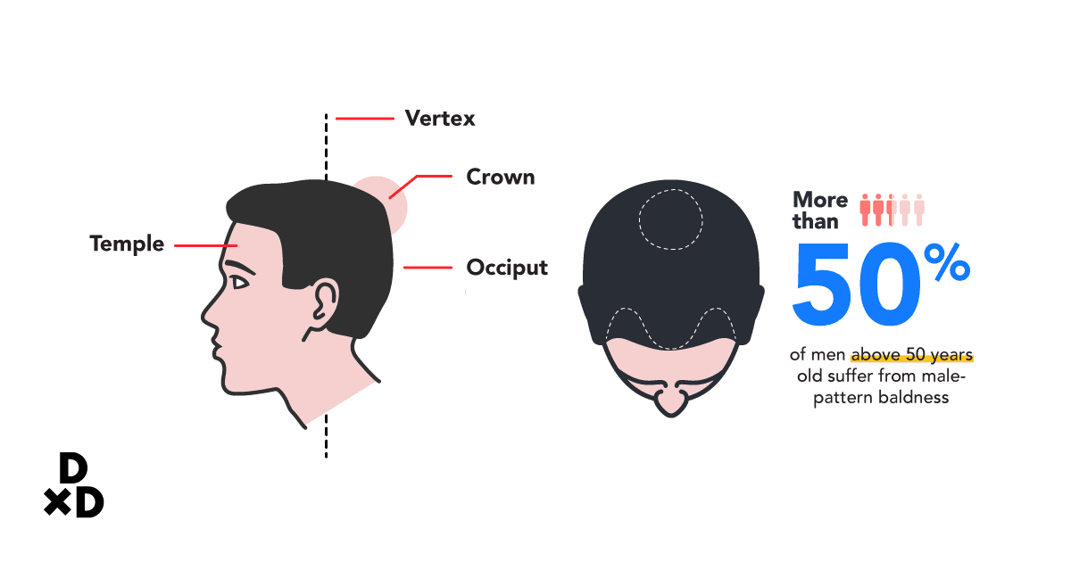 parts of the head showing where the temples / vertex / crown/ occiput are