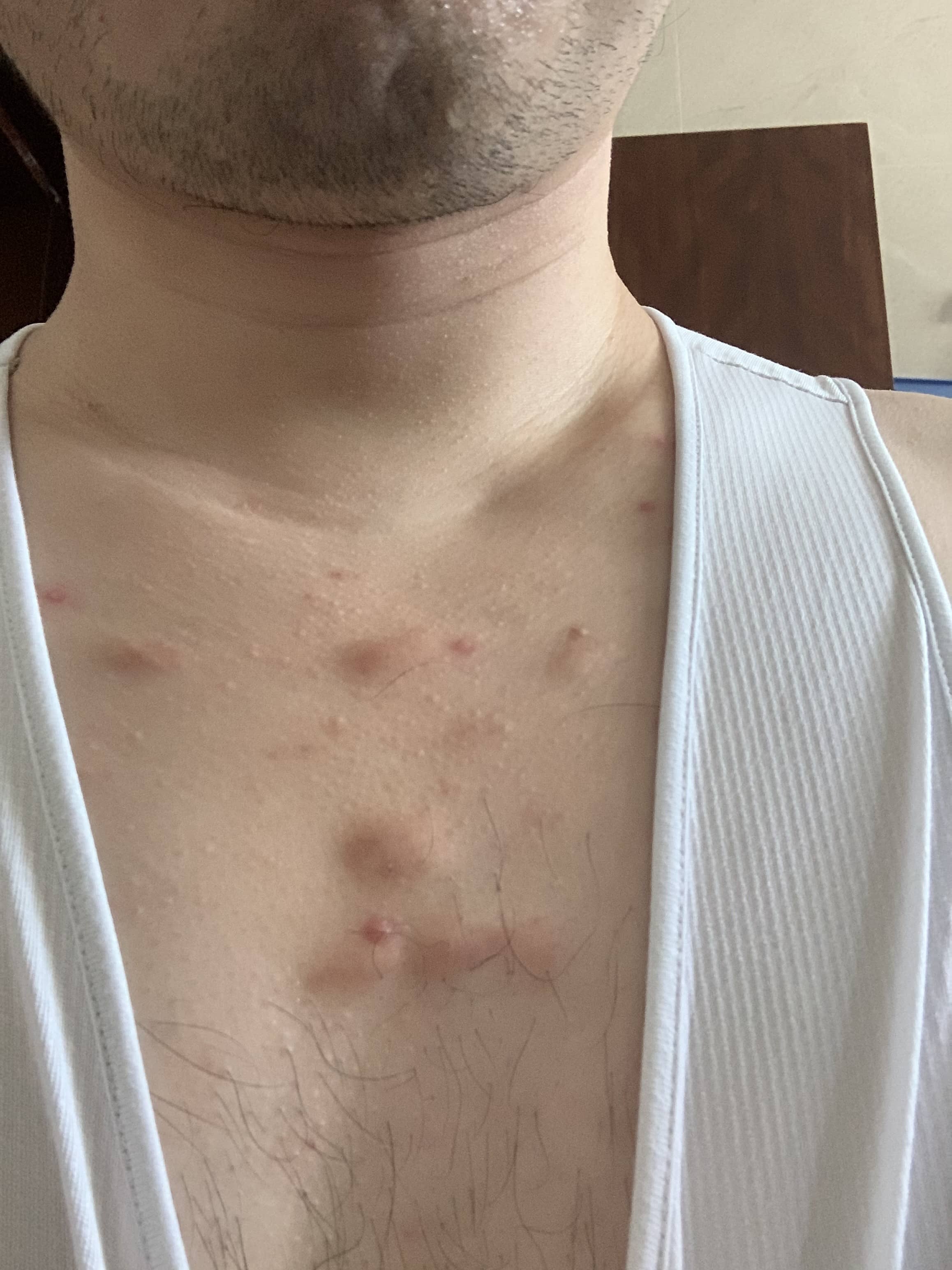 Why Are There Small Red Bumps On My Chest