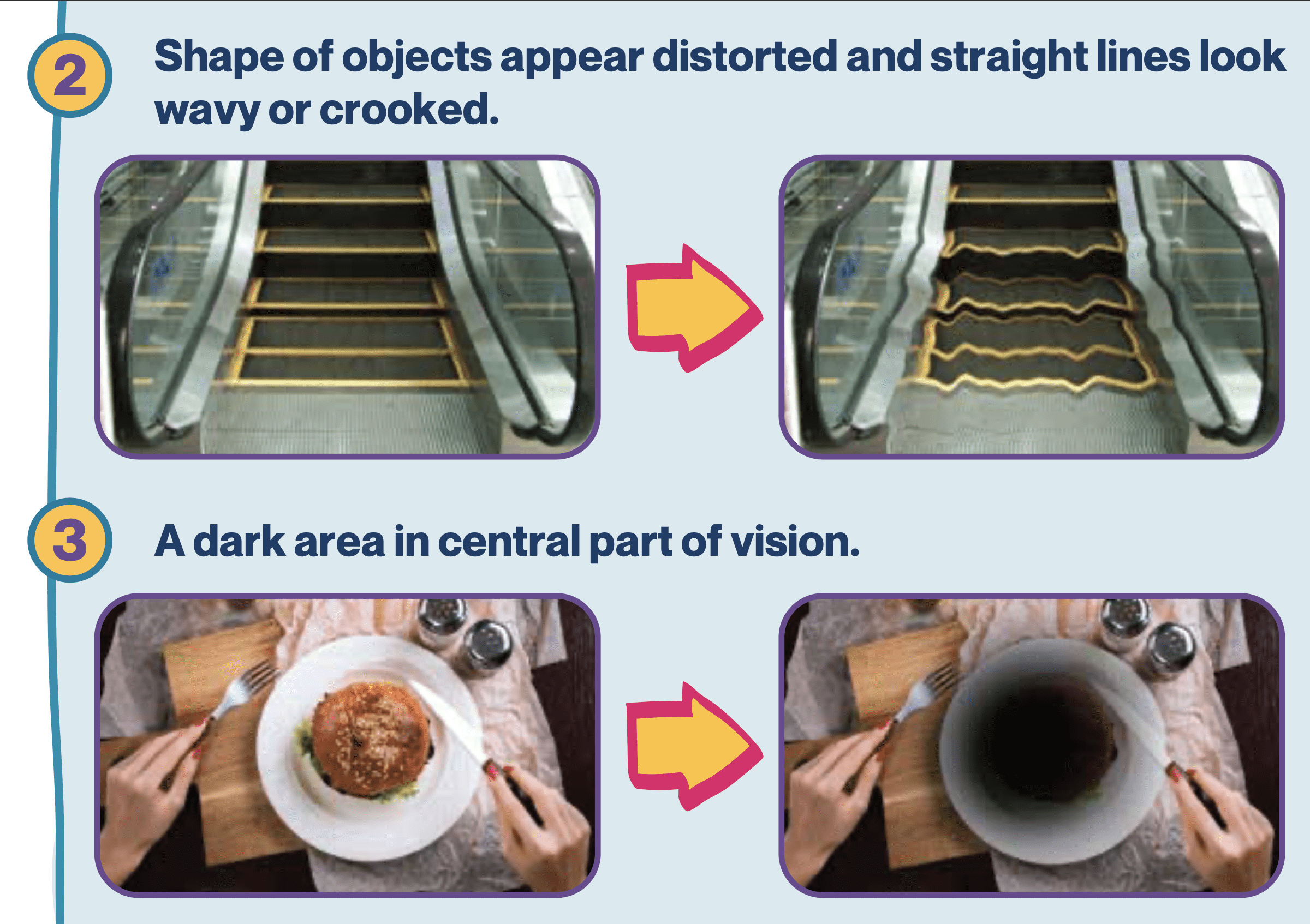 Visual distortion from AMD