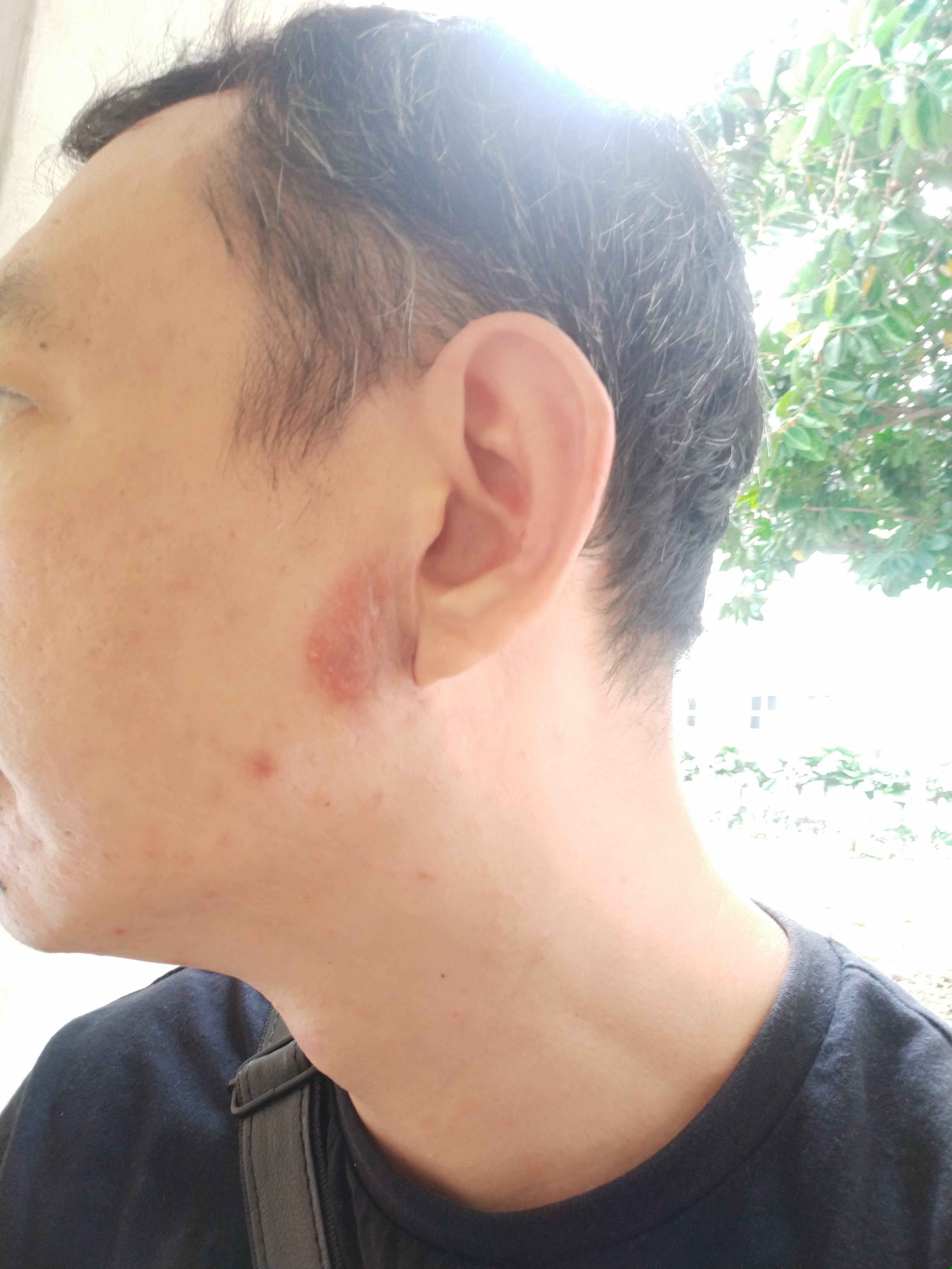 what-causes-clear-yellowish-fluid-discharge-on-the-face-photo-human