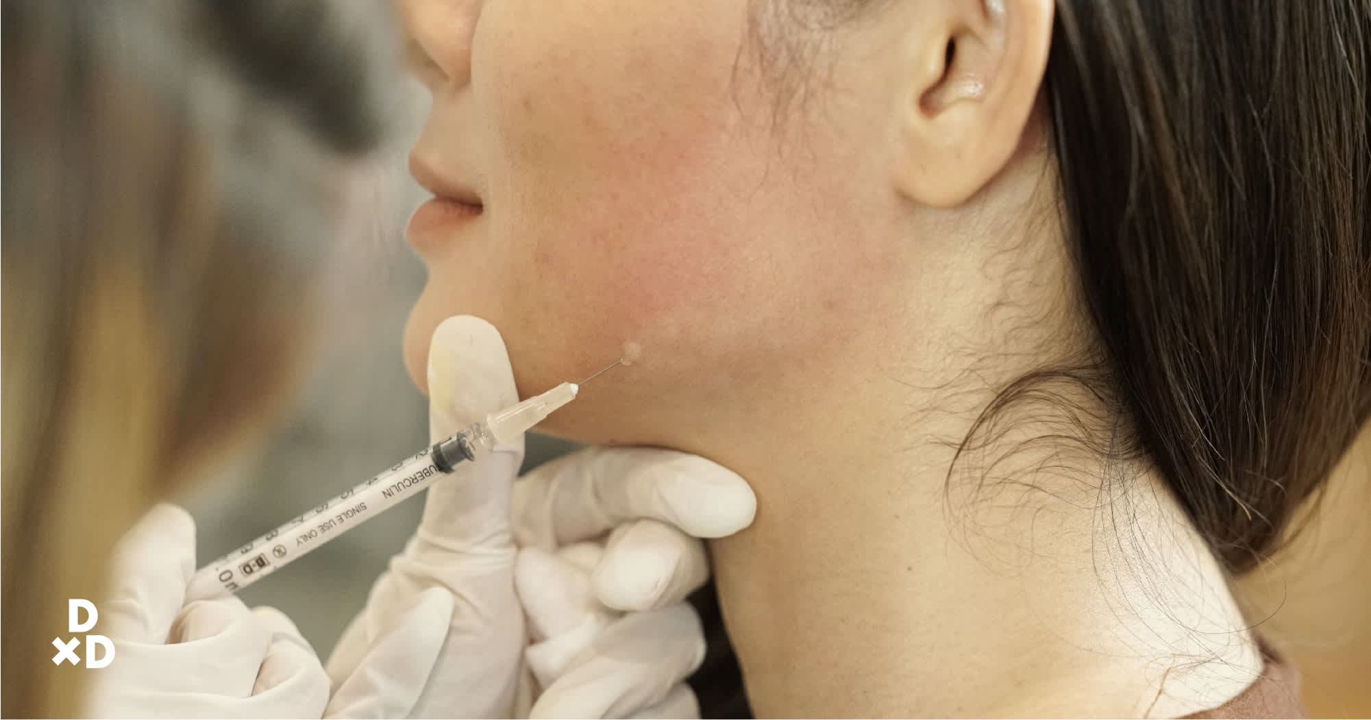 injectables for skin tightening