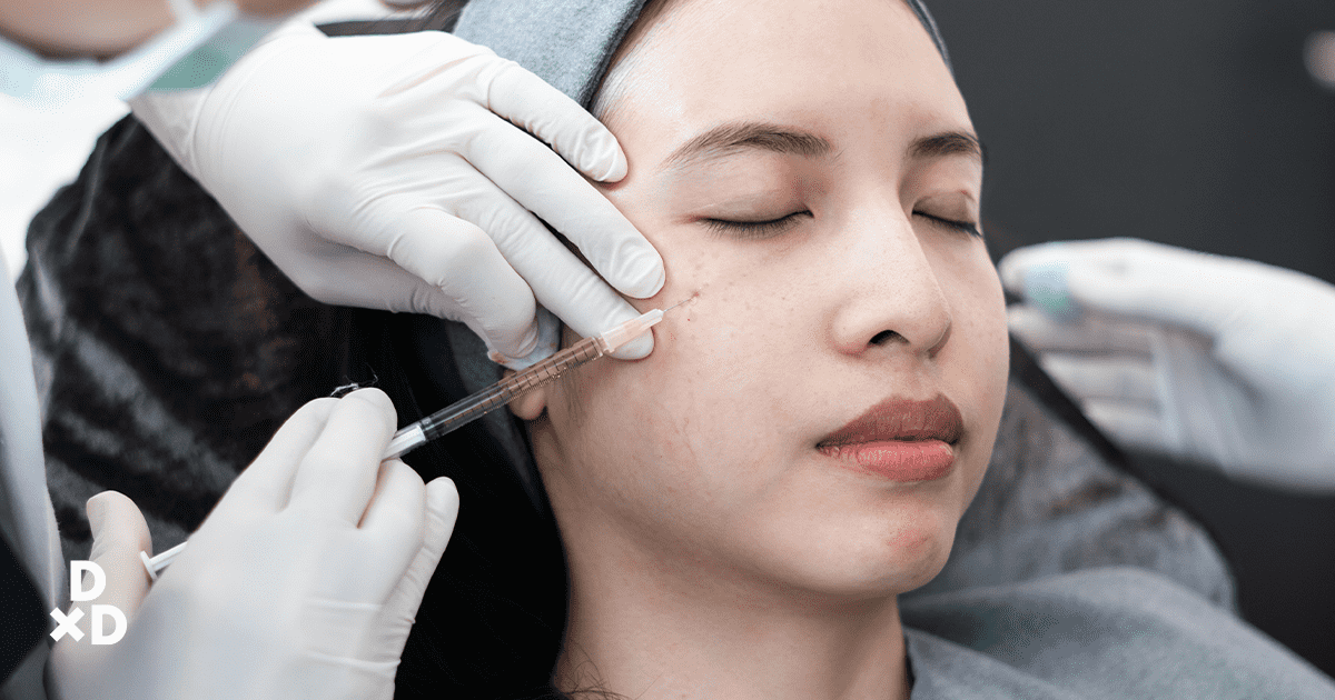 girl getting dermal fillers