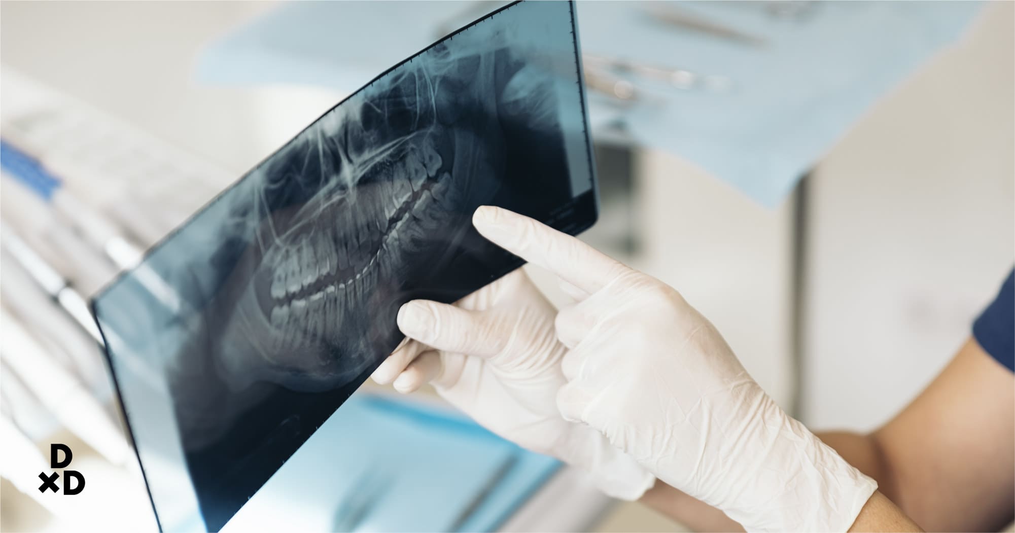 dental xray