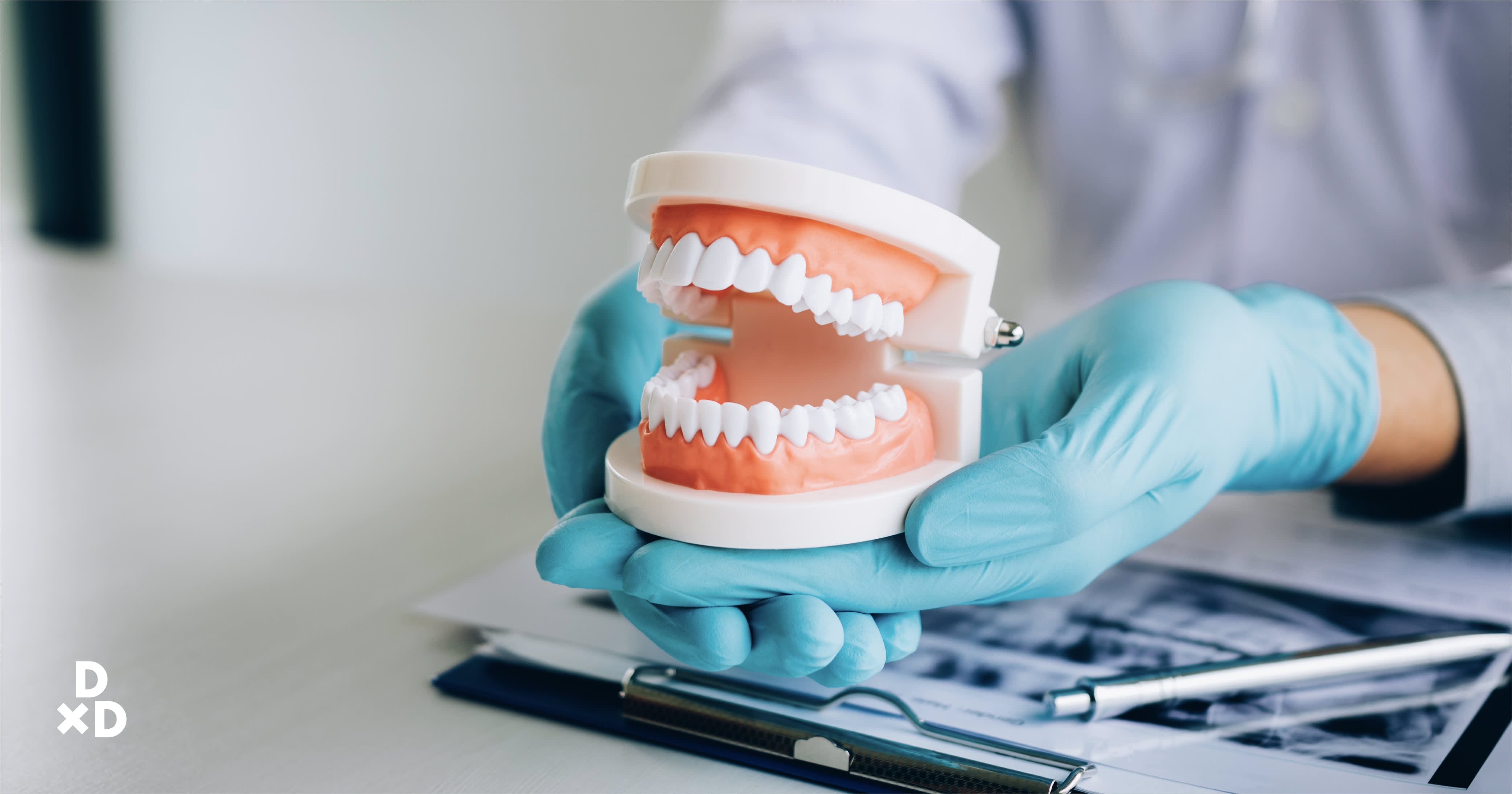 diagnosing bruxism