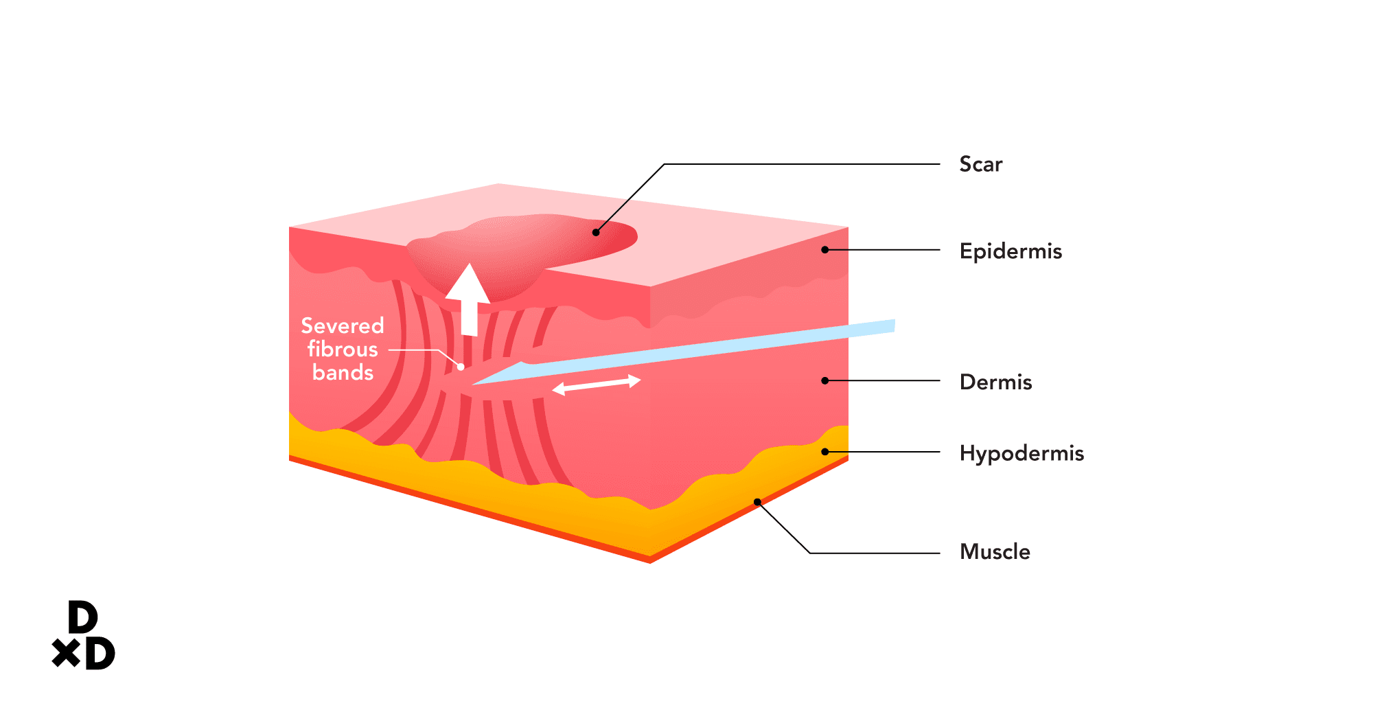 dermal illustration