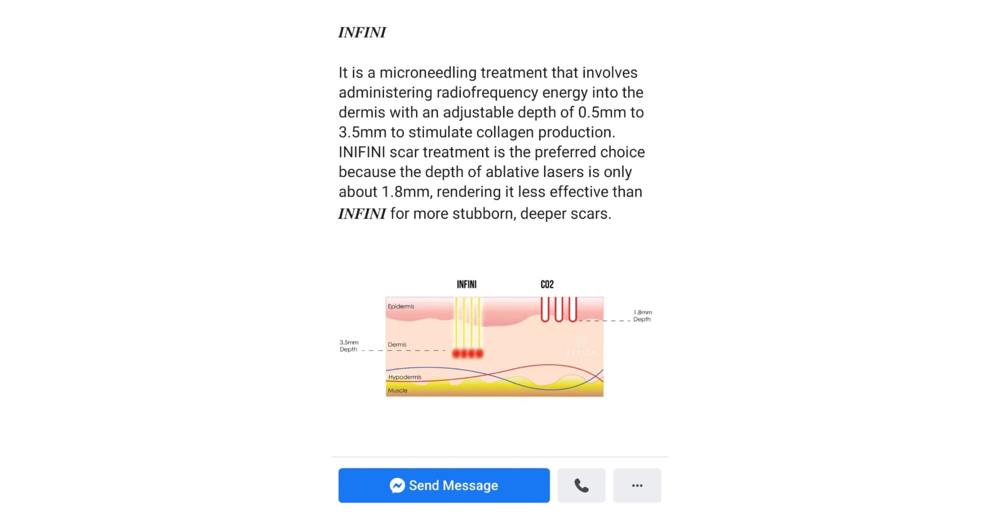 misleading facebook ad for microneedling