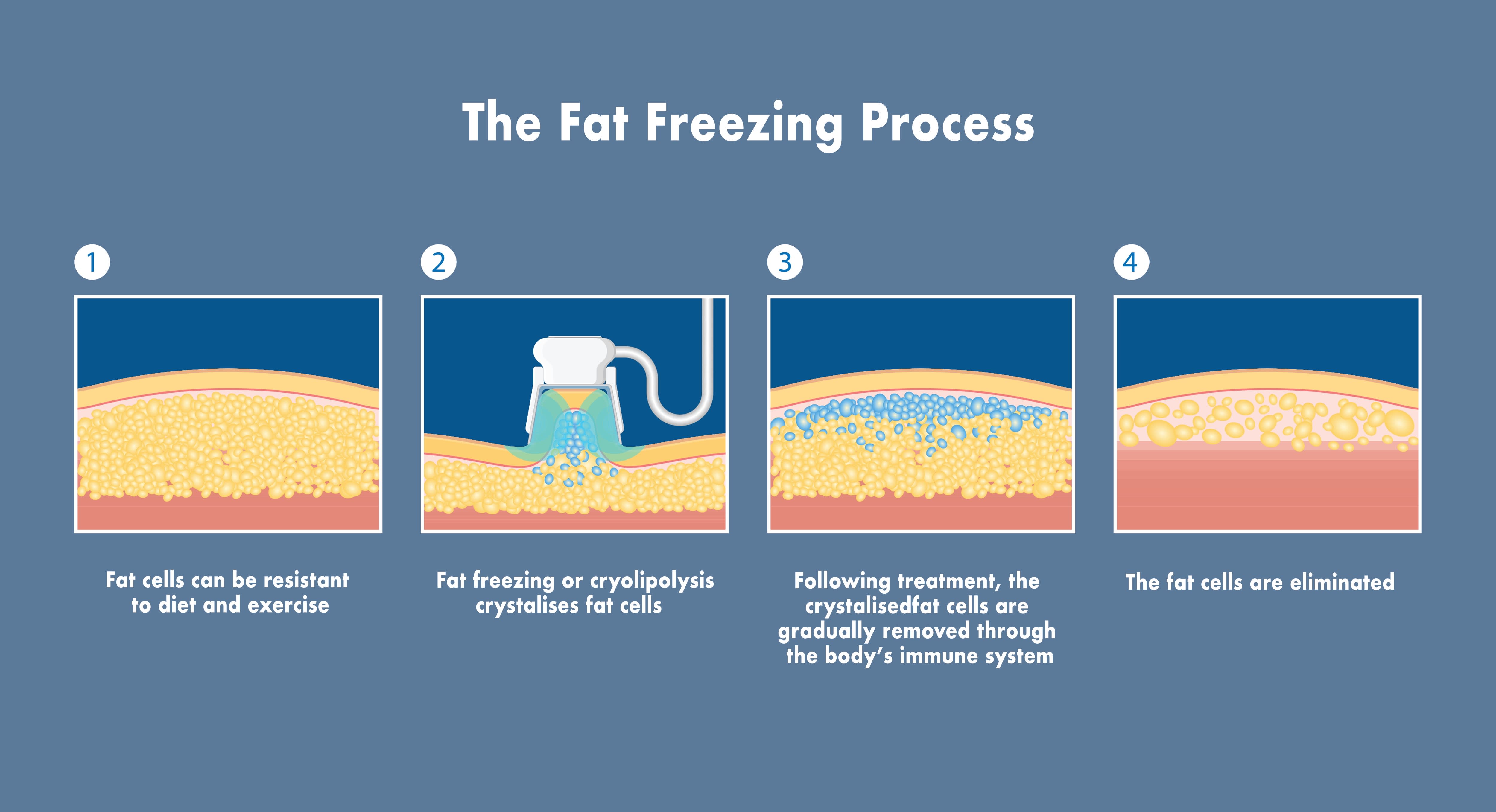 Fat freezing process