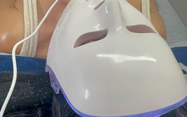 Experience of Facial Lifting by IYARI in Puerto Vallarta photo 5