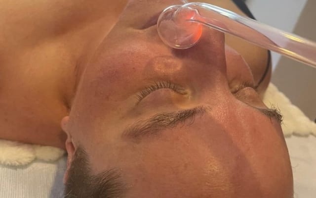 Experience of Facial Lifting by IYARI in Puerto Vallarta photo 4