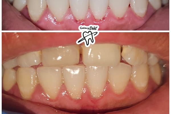 Dentista en tulum