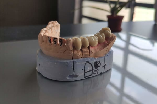 Consultorio dental Mérida | Dentista emergencias