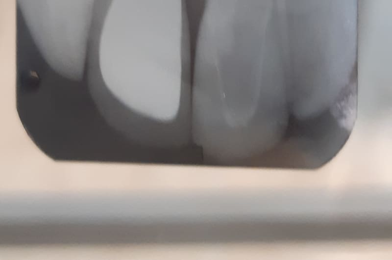Debra Baqueiro | Periodoncia e Implantología — photo 3