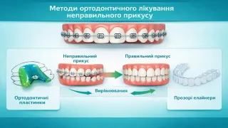 Коли дитині потрібен ортодонт: ознаки для батьків
