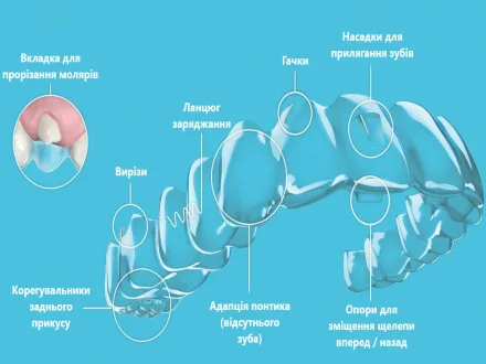 Як доглядати за елайнерами: прості правила