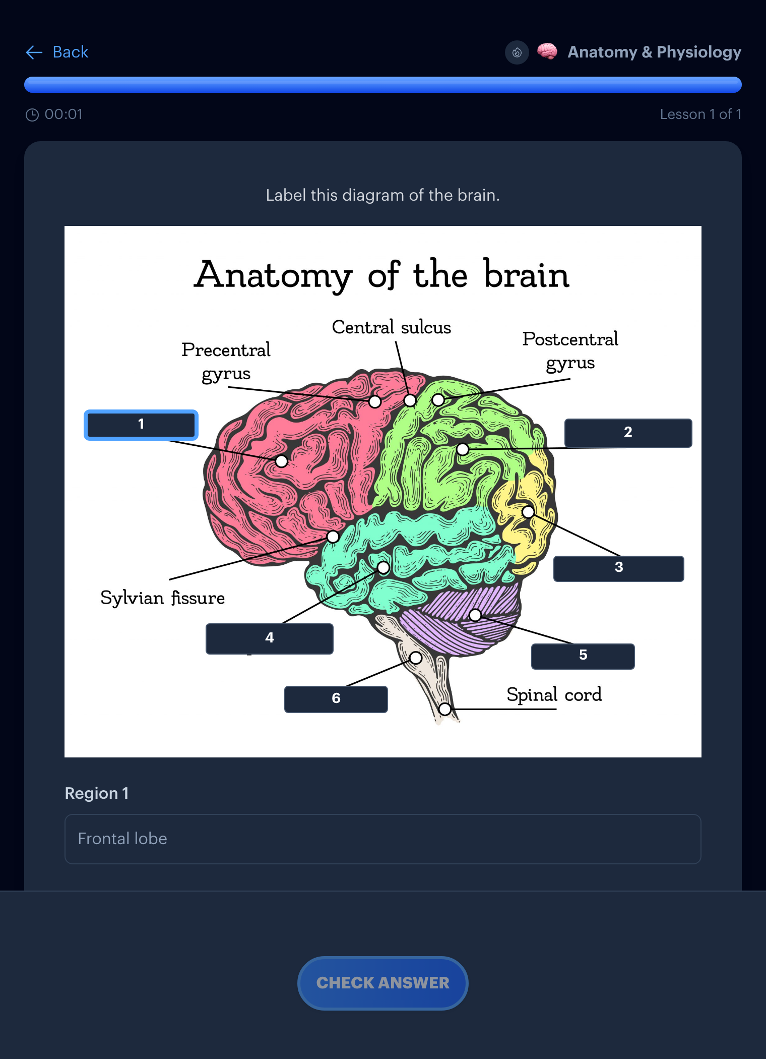 An image occlusion lesson in Interact labeling a diagram of the brain
