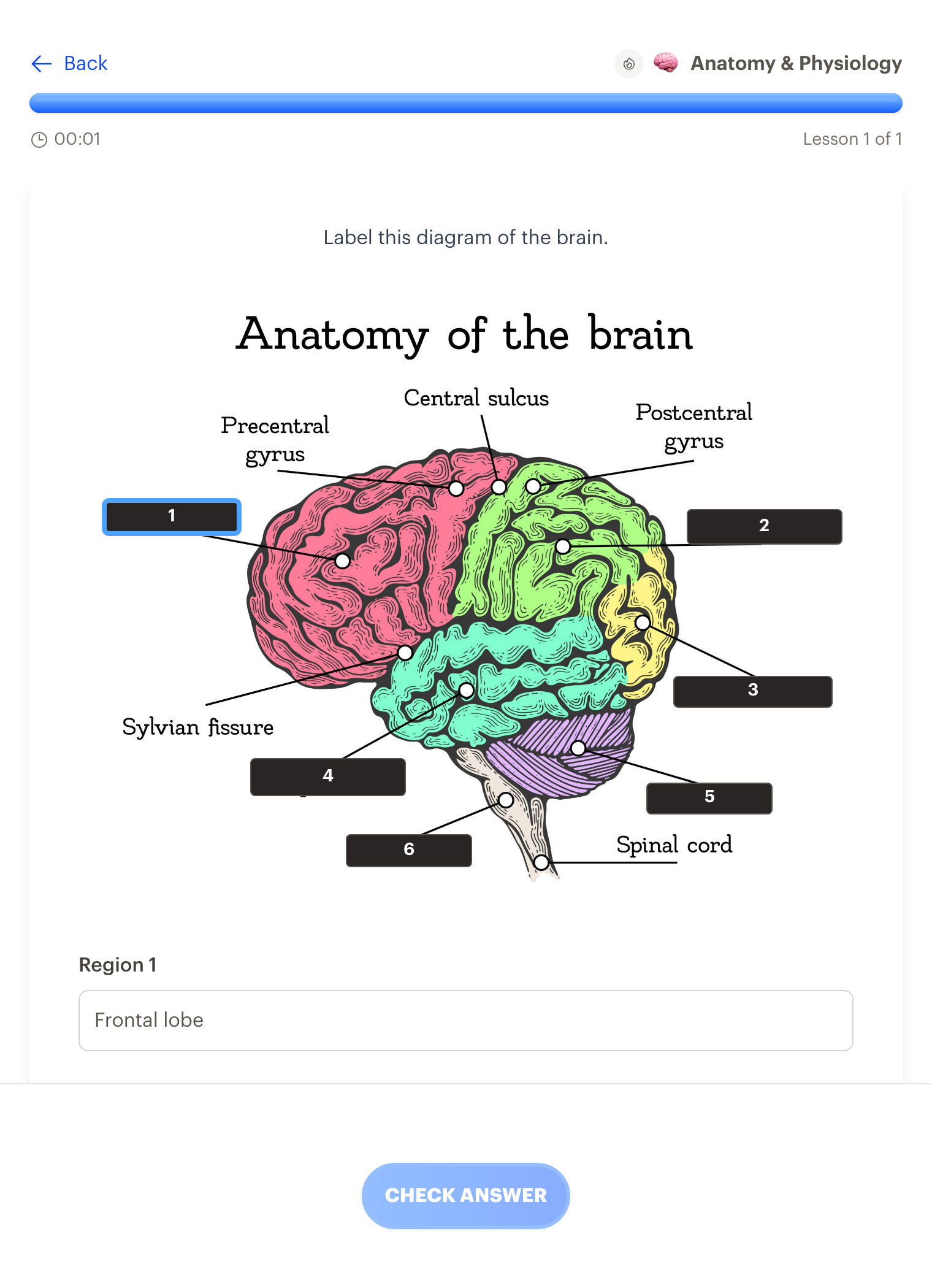 An image occlusion lesson in Interact labeling a diagram of the brain