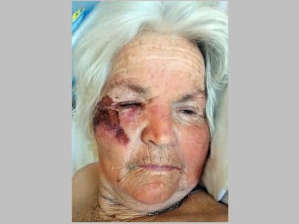 В Ростовской области ищут родственников найденной пенсионерки с потерей речи