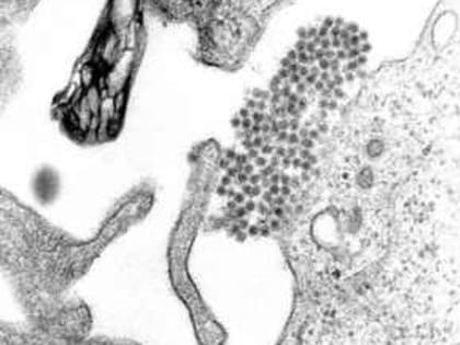 Ученые ЮФУ открыли еще один секрет самосборки вирусов в клетках