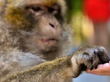 В России выписали из больницы единственного пациента с оспой обезьян