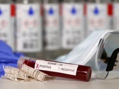 Заболели 9, выздоровели 67: статистика по COVID-19 в Волгодонске