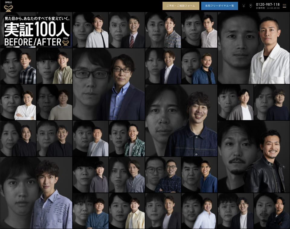 gorilla clinic 100人Before/After